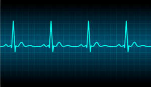 Abbildung eines Herz-EKGs
