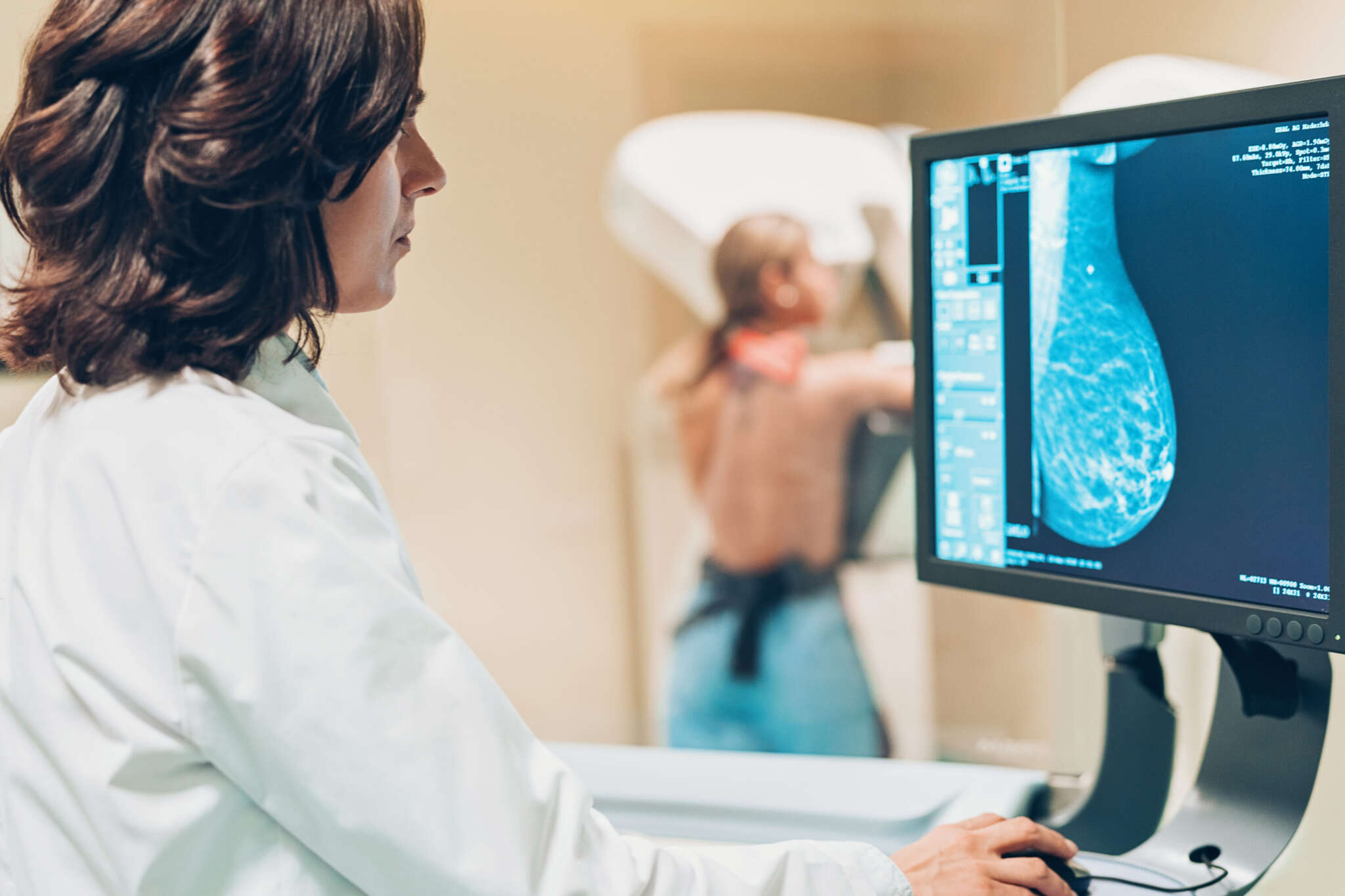 Eine Ärztin betrachtet eine Mammografieaufnahme auf einem Monitor, während im Hintergrund eine Patientin untersucht wird.